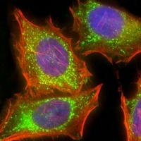 Anti-FIH-1 Antibody