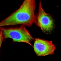 Anti-EIF2B3 Antibody