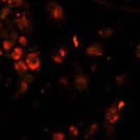 Anti-LIN28A Antibody
