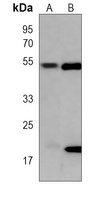 Beta1-tubulin Antibody