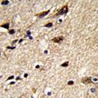 Beta1-tubulin Antibody