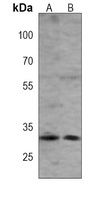 GOLPH3 Mouse Monoclonal Antibody