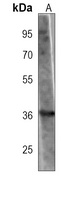 FN3K Mouse Monoclonal Antibody