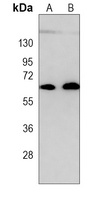 CARD9 Mouse Monoclonal Antibody