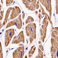 Anti-Makorin-2 Antibody