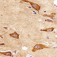 Endobrevin Mouse Monoclonal Antibody