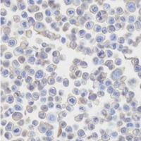 Anti-CD273 Antibody