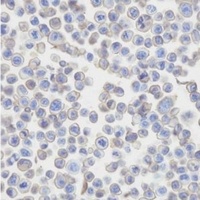 CD273 antibody