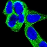 Anti-CRMP-5 Antibody