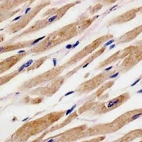 Anti-RANBP9 Antibody