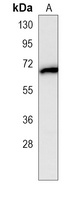 CaMKK beta Mouse Monoclonal Antibody