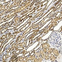 Anti-BBS4 Antibody