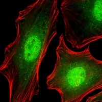 Anti-FUBP3 Antibody