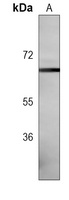 DYRK2 Antibody