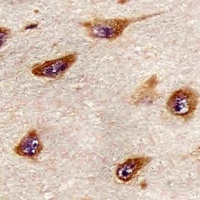 Anti-ATG4A Antibody