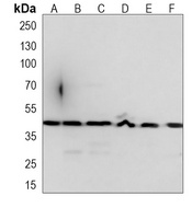 CREB3L4 Mouse Monoclonal Antibody