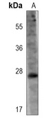 LYPD6B Antibody