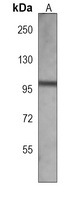 HIPK4 Antibody