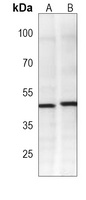 CDK20 Mouse Monoclonal Antibody