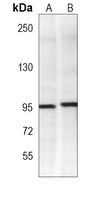 HACE1 Mouse Monoclonal Antibody