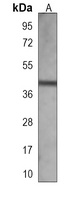 FAT4 Mouse Monoclonal Antibody
