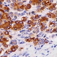 Anti-REG3 gamma Antibody