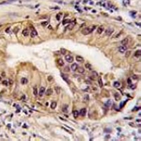Anti-ATG16L1 Antibody