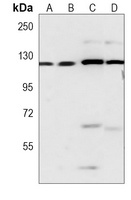 DAB2IP Mouse Monoclonal Antibody