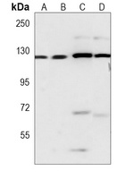 RNF20 Mouse Monoclonal Antibody