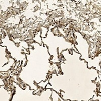 Anti-CD167b Antibody