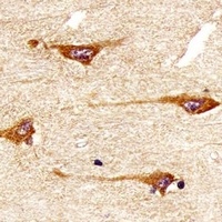 TRK B antibody