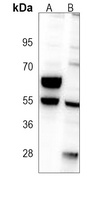 CRMP2 Antibody