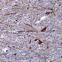 Alpha-internexin antibody