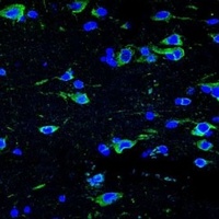 Alpha-internexin antibody