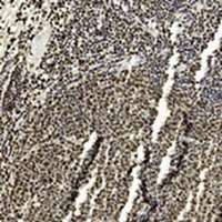 Anti-EZH2 Antibody