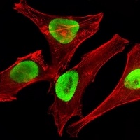 Anti-EZH2 Antibody