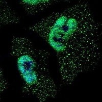 Anti-HUR Antibody