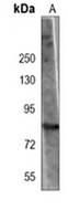 RSK1 Mouse Monoclonal Antibody