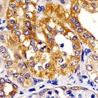 IRF3 antibody