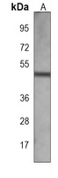 FAT1 Mouse Monoclonal Antibody