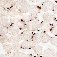 Anti-PPAR alpha Antibody