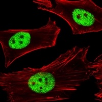 Anti-PPAR alpha Antibody