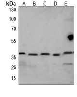RAD51A Mouse Monoclonal Antibody