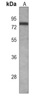 BTK Mouse Monoclonal Antibody