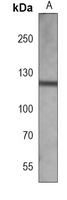 Focal Adhesion Kinase Mouse Monoclonal Antibody