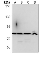 LLH Mouse Monoclonal Antibody