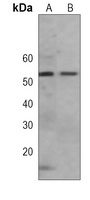 ALDH6A1 Antibody