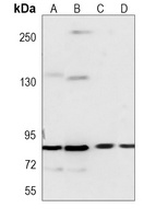 PFKP Mouse Monoclonal Antibody