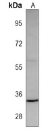 MC1 Receptor Mouse Monoclonal Antibody