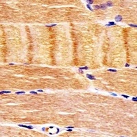 Anti-CDK5 Antibody